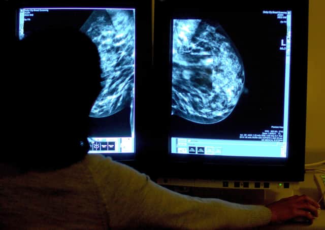 The target for patients to begin cancer treatment after diagnosis is 95%