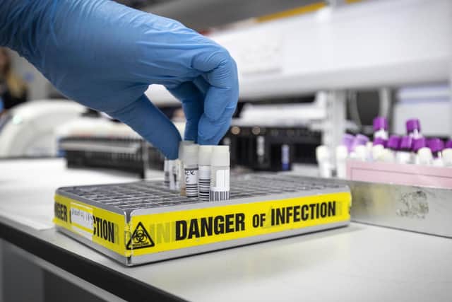 A first coronavirus case has been confirmed in Northern Ireland