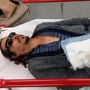 Photo issued by Schillings of Johnny Depp being taken to hospital with a severed finger, following an incident in Australia in March 2015. Photo: Schillings/PA Wire