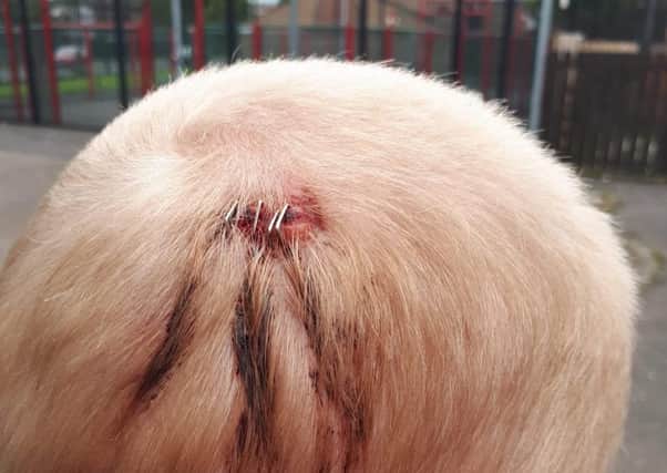 Robert McClean from Tigers Bay shows wounds on his head after being attacked by a gang of youths in what police are treating as a hate crime.