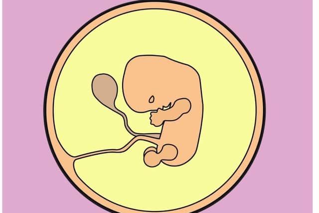 NHS image depicting a foetus at 10 weeks