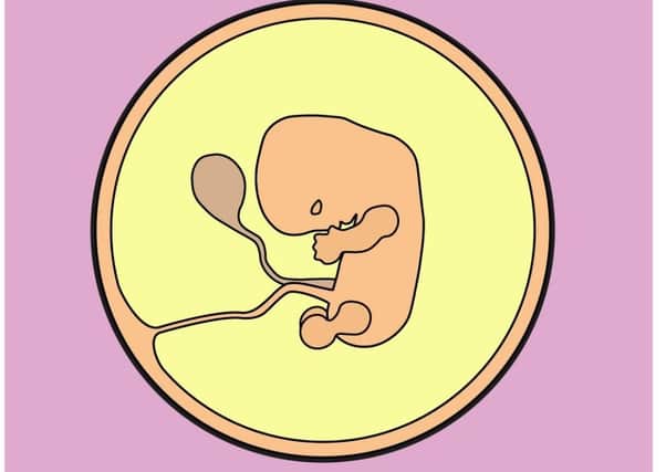 NHS image depicting a foetus at 10 weeks