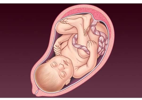 An NHS image of a foetus at a late stage of gestation; the new abortion framework brought in during spring allows for abortion up until the point of birth in Northern Ireland (though such cases may well prove relatively rare)