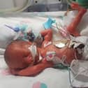 Sophia was born at 26 weeks and weighed just 1lb 10oz