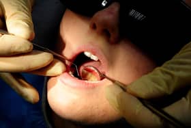 Almost 5000 children are admitted to hospital in NI each year to have five teeth removed under general anaesthetic.