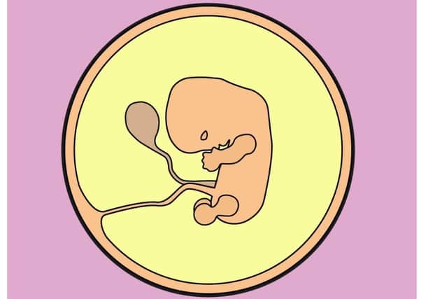 A foetus at the 10-week mark of gestation, from NHS online