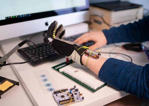 The robotic glove measures electrical activity in response to a nerve’s stimulation of the muscle