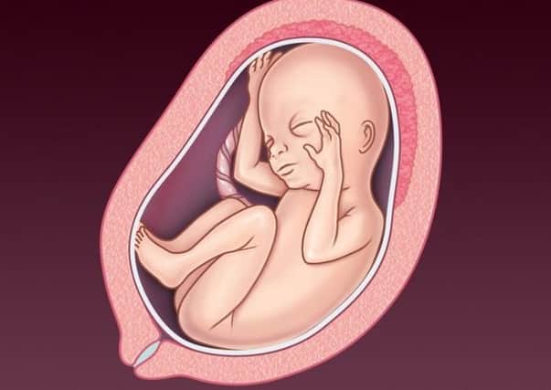 NHS pregnancy service image depicting a foetus at 21-to-24 weeks' gestation