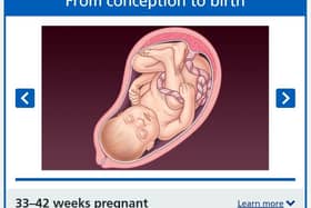 Image from the NHS of a foetus at 33 to 42 weeks of gestation (final phase)