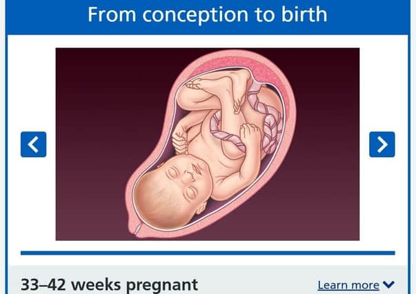 Image from the NHS of a foetus at 33 to 42 weeks of gestation (final phase)