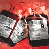 Collection rates for the NI Blood Transfusion Service are only about 60% of normal
