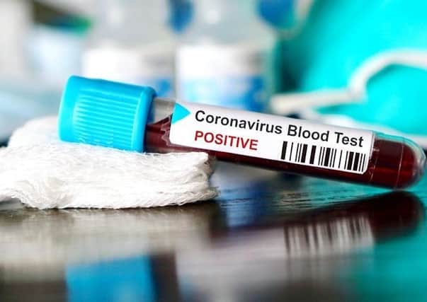 A pledge on coronavirus tests for residents and staff in care homes has been widely welcomed