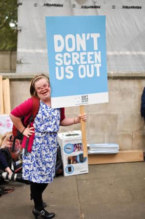 A campaigner with Down's Syndrome. Photo: Heidi Crowter/PA Wire

N