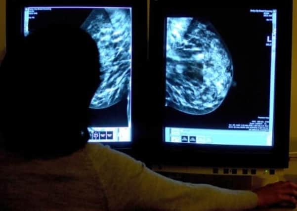 850 women are awaiting breast screening in Northern Irelaland