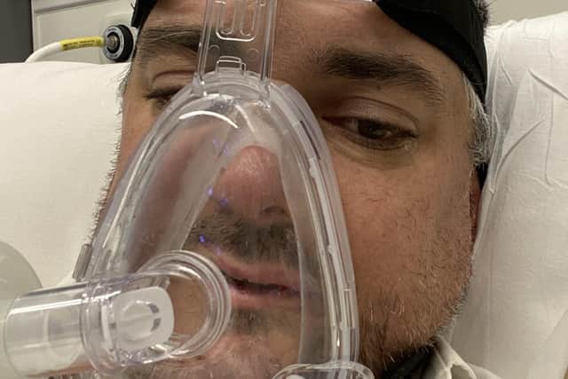 Simon is pictured wearing the CPAP (Continuous Positive Airway Pressure) oxygen therapy mask.