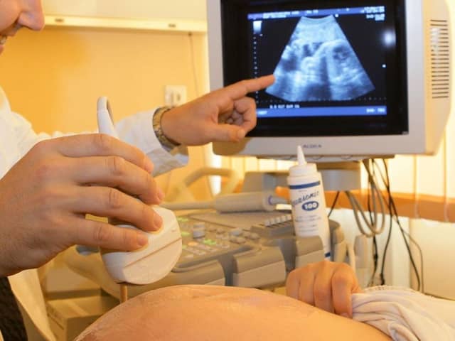 A pregnancy scan