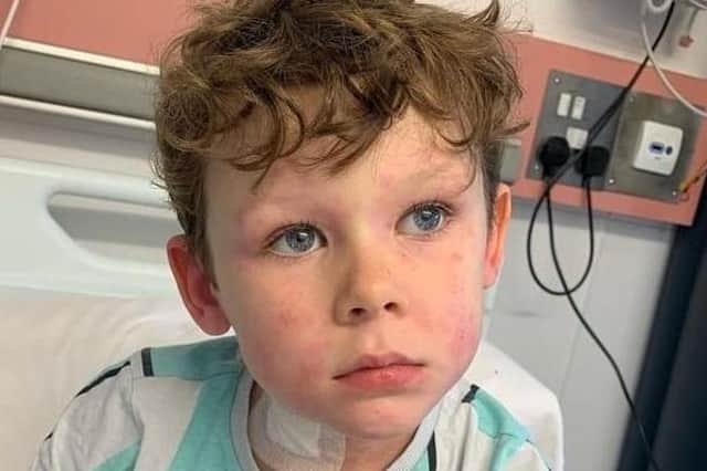 Seven-year-old Olcan Wilkes, who suffers from a rare and life-threatening condition called aplastic anaemia, has finally found a rare bone marrow donor after making a TV appeal