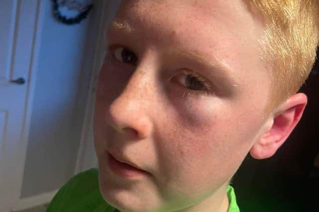 The youngster who was attacked in north Belfast