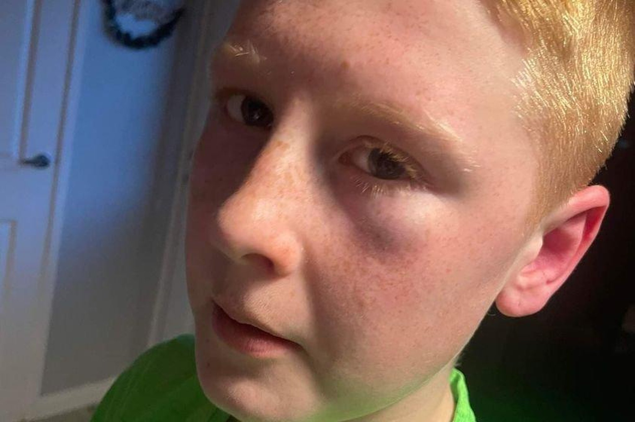 'Savage and unprovoked sectarian attack' on 13-year-old boy condemned