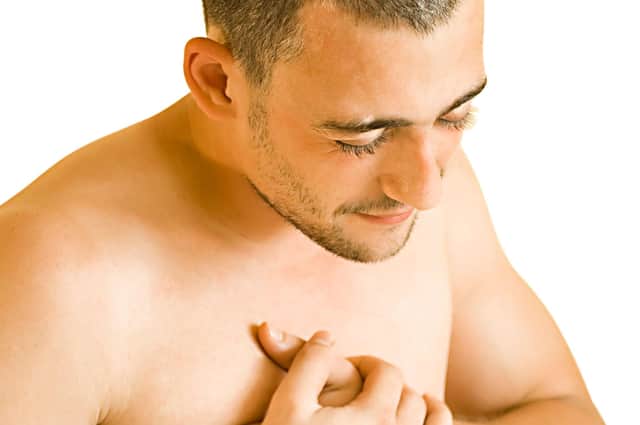 Everything you need to know about male breast cancer, as a new