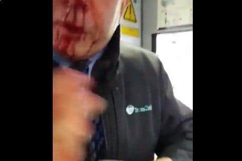 The video posted online shows the Translink employee attempting to stem the flow of blood from a facial injury.