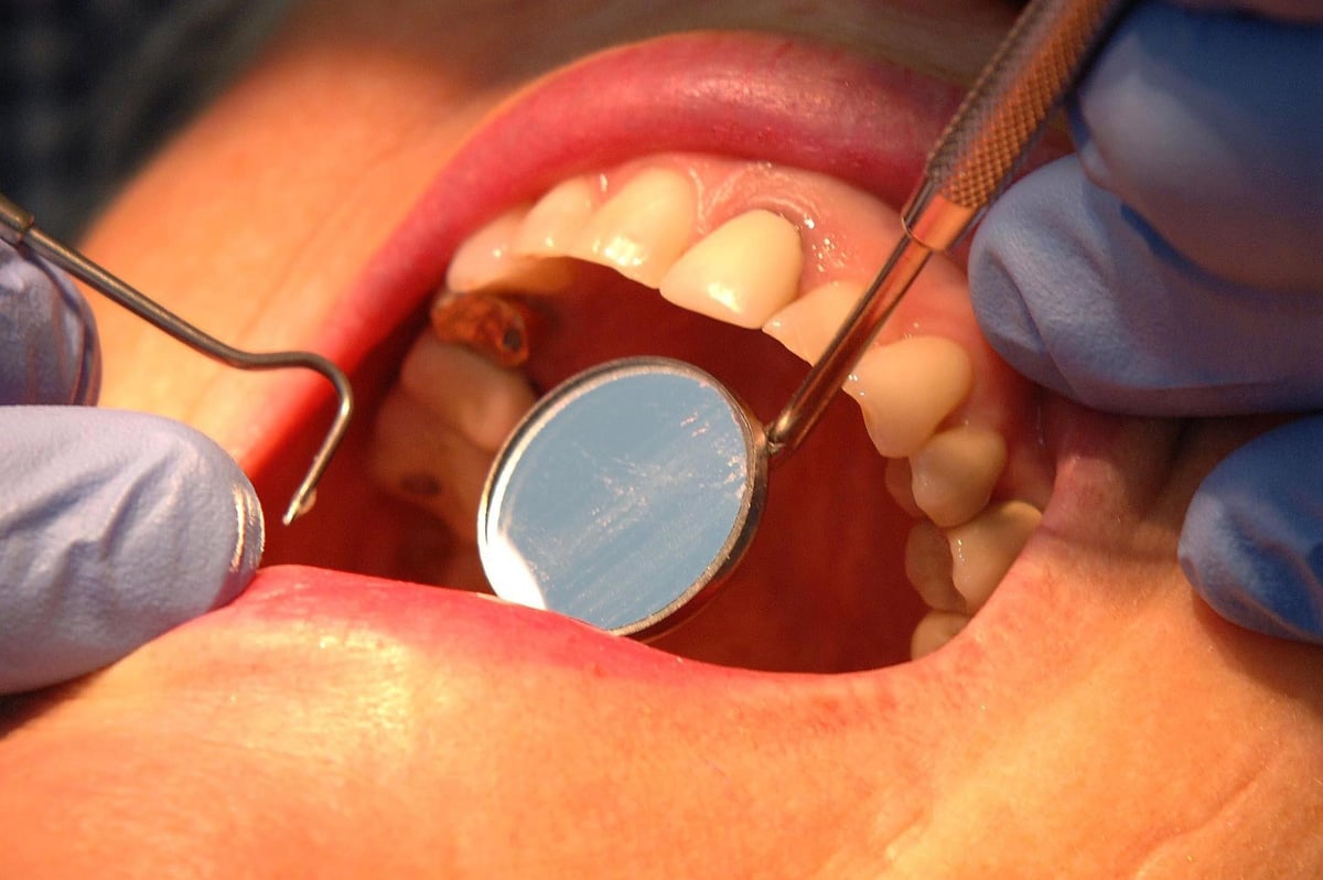 'Dentistry crisis has reached tipping point' British Dental Association Northern Ireland warns