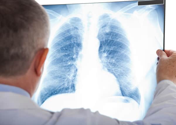 The lung cancer treatment has not been approved for Northern Ireland