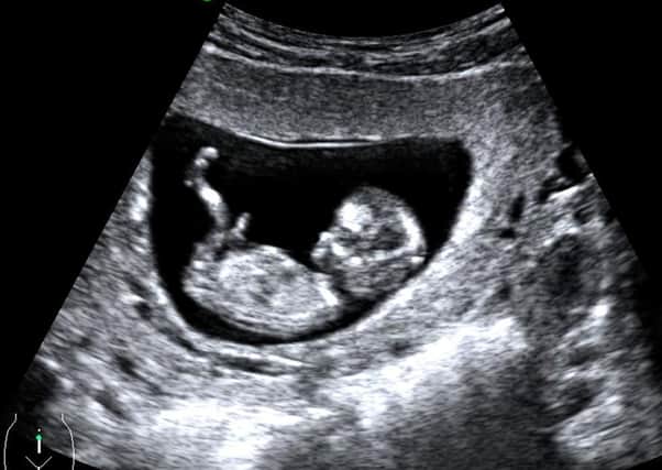 An image of a foetus at 12 weeks, from the NHS website; at that age the spine, limbs, and heartbeat are all visible