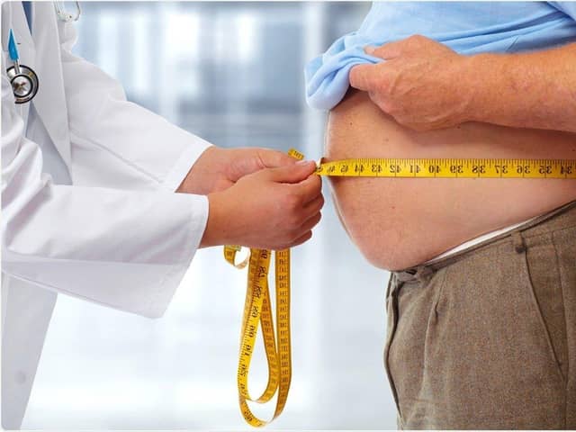 Obesity makes your risk of heart attack and stroke significantly higher
