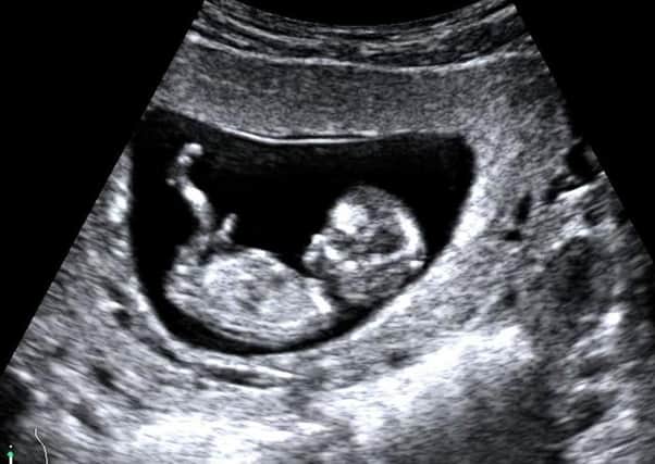An image of a foetus at 12 weeks (to which Dr Hardy refers). It is taken from the NHS website; at that age the heartbeat and other features are visible