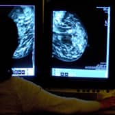 The Royal College of Radiologists said that breast imaging and treatment services were already ‘massively under-resourced’
