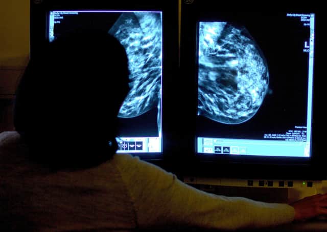 The Royal College of Radiologists said that breast imaging and treatment services were already ‘massively under-resourced’