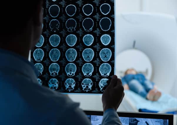 New report finds that neurology services in the UK are severely stretched
