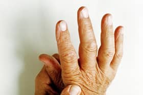 As well as joint pain, rheumatoid arthritis can cause problems with the organs