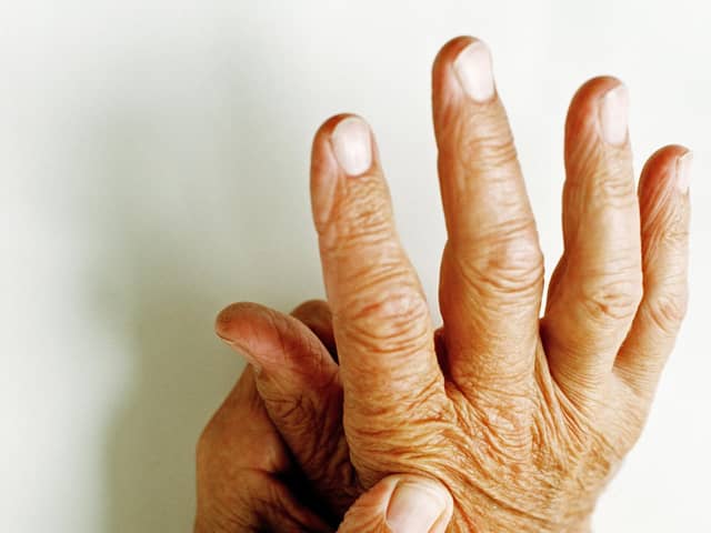 As well as joint pain, rheumatoid arthritis can cause problems with the organs