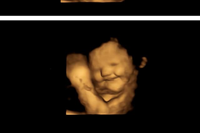 A baby in the womb 'smiles' for carrots
