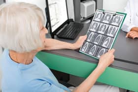 According to Cancer Research UK, nearly half of all new lung cancer cases are diagnosed in people aged 75 and over