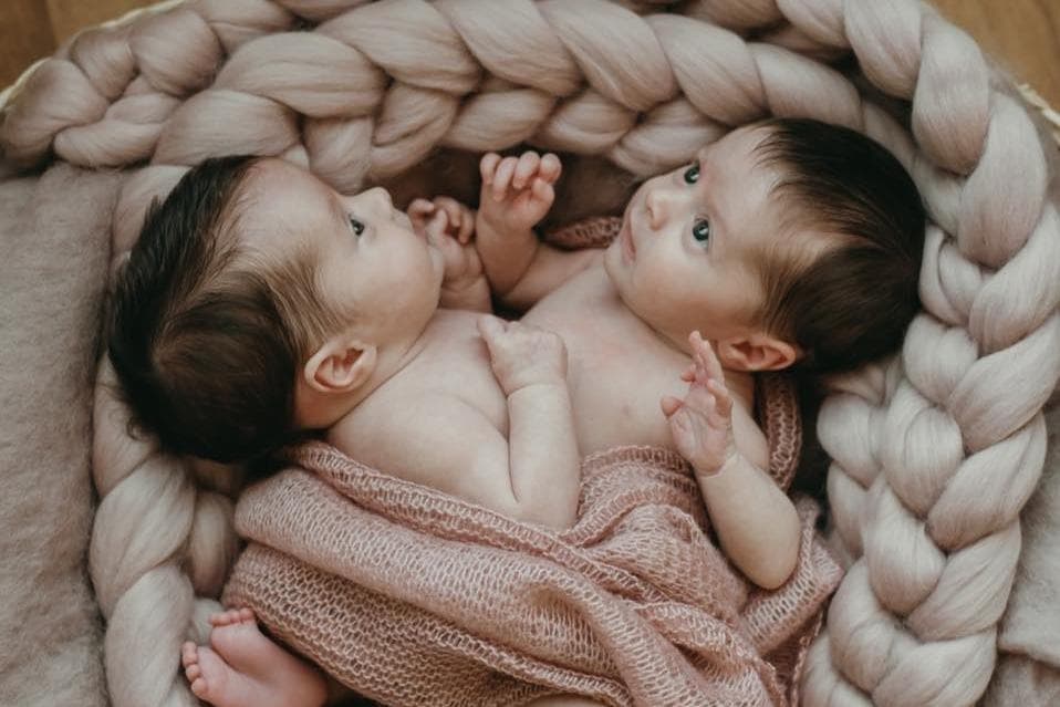 'Mixed emotions' as conjoined Bateson twins hit one year milestone of separation