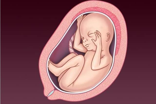 An image from the NHS showing the development of a foetus by 21-24 weeks