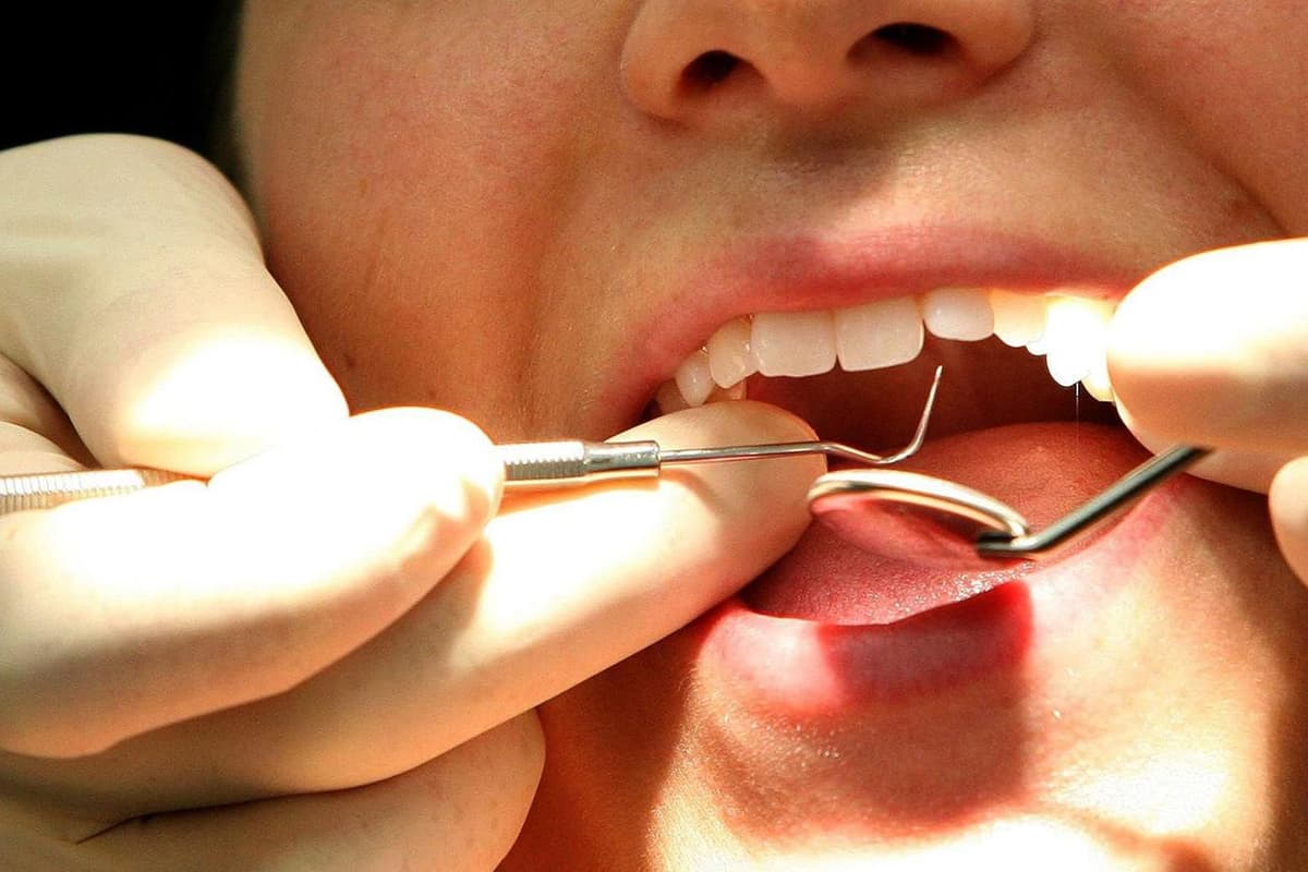 The proposal to ban amalgam has 'sent shockwaves' across the entire dental profession in NI