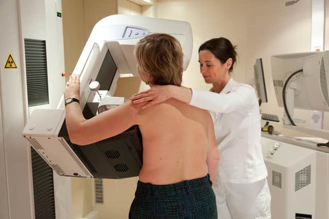 Women with a family history of breast cancer have a higher risk of developing the disease.