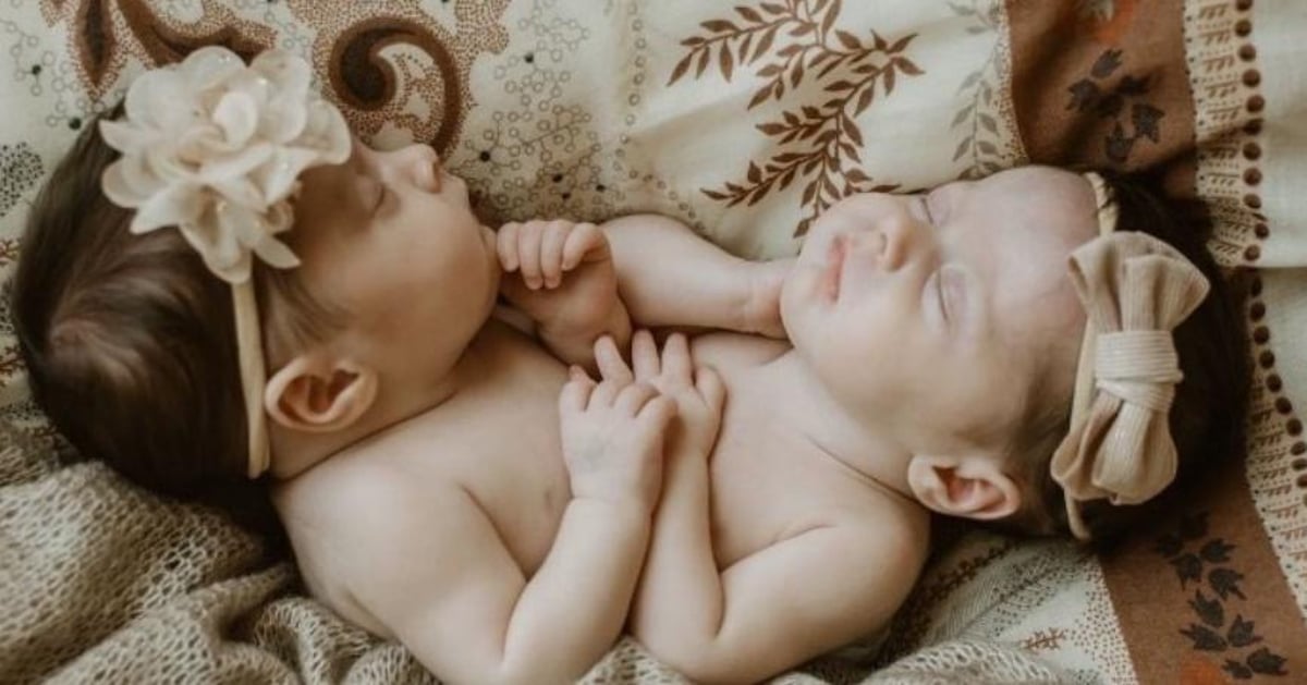 'The big day is nearly upon us' reveals parents of conjoined twins ahead of London operation