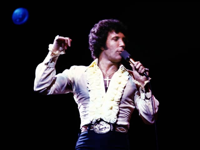 Welsh singer Tom Jones was famous for this hairy chest and medallions