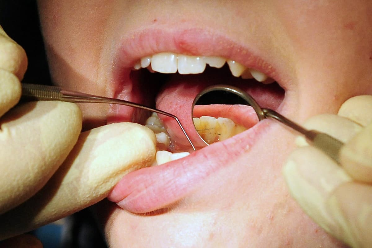 Dental care in Northern Ireland faces an 'existential threat' from 'insulting' fees for dentists, says trade union