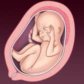 NHS image of a foetus at 21-24 weeks