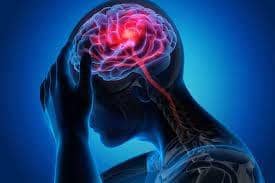 World Stroke Day is held annually on October 29