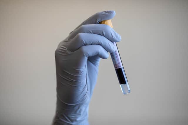 A blood test that looks for changes in certain proteins could predict dementia up to 15 years before diagnosis, research suggests.