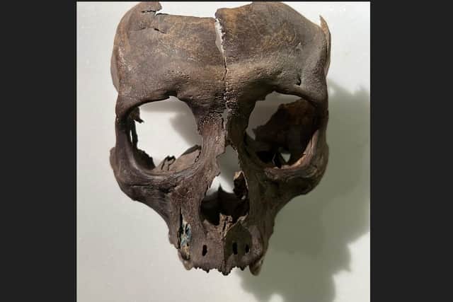 The archeologists recovered part of a human skull from the 'King's Stables' area of the site near Armagh.