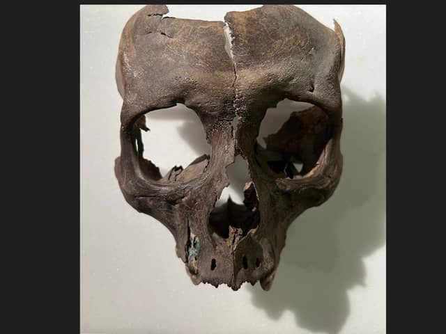The archeologists recovered part of a human skull from the 'King's Stables' area of the site near Armagh.