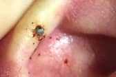 Hyalomma ticks: main transmitter of Crimean-Congo fever